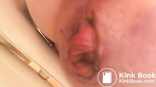 prolapse and shit37