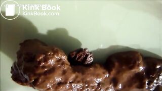 Scat1187