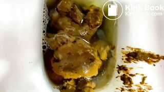 Diarrhea attacks