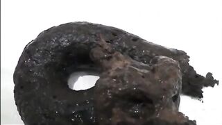Girl's poop is black