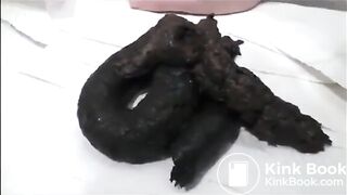 Girl's poop is black