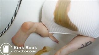 White skirt diarrhea