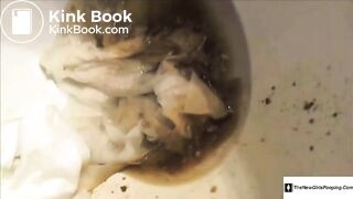 colonoscopy - video 3