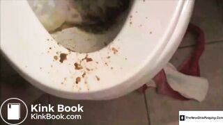 colonoscopy - video 3