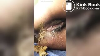 Ebony shitty anal dildo - video 2