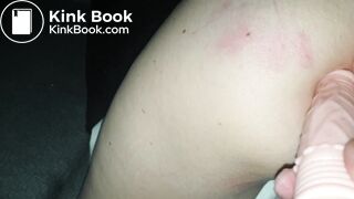 accident dildo big ass