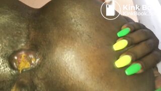 Ebony young diarrhea