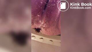 Skinny poops and piss