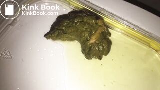 You Need a Sample of MY Poo