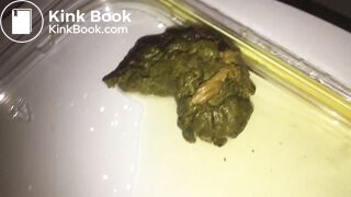 You Need a Sample of MY Poo