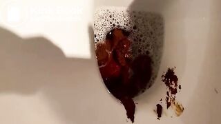 Huge poop viewed close up