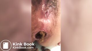 Hot Slow Knobbly Poop