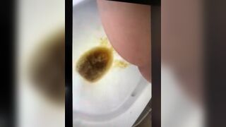 girl liqudid diarrhea