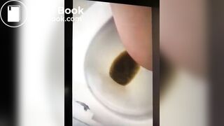 girl liqudid diarrhea