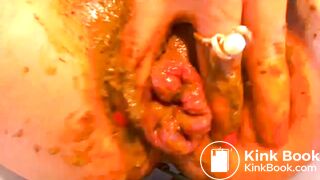 Shit-Covered Silently Barking Prolapsed Anus