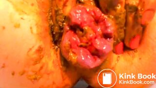 Shit-Covered Silently Barking Prolapsed Anus