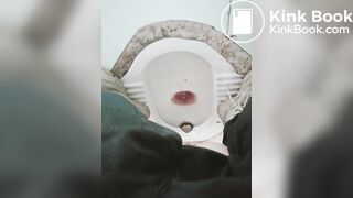 拉肚子了2