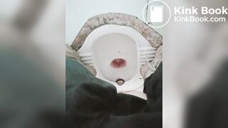 拉肚子了2