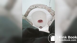 拉肚子了2