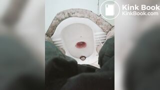 拉肚子了2