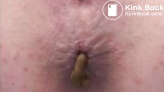 Dipping Her Foot into Her Diarrhea on the Table