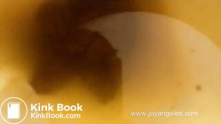 Soft poop - video 7
