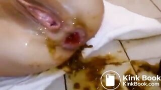 Scat prolapse - video 3