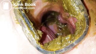 Solo Scat Sluts 22: Pussy Shit Stuffing (Part 4 of 4)