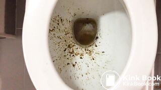 Different types of shit on one day, diarrhea