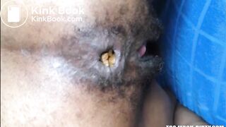 Hairy girl shitting an hard turd