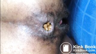 Hairy girl shitting an hard turd