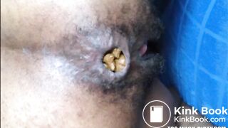 Hairy girl shitting an hard turd