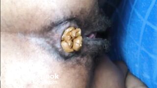 Hairy girl shitting an hard turd