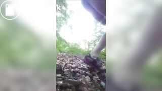 Diarrhea With Loud Hissing Pee