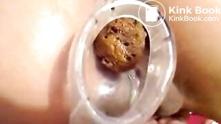 shitting in speculum