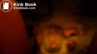 Explosive diarrhea the next morning