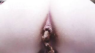 Same Pale Bottomed Girl make a proper ring stretcher!