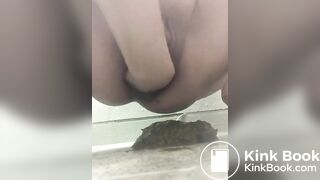 prolapse and shit21