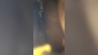 Wife bag poop and pee