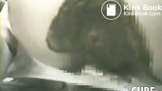 Massive diarrhea in pantyhose