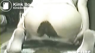 Massive diarrhea in pantyhose