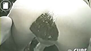 Massive diarrhea in pantyhose