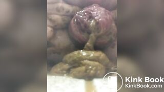 prolapse and shit16