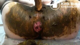 Scat anal prolapse video