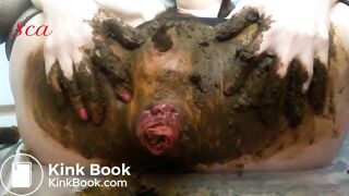 Scat anal prolapse video