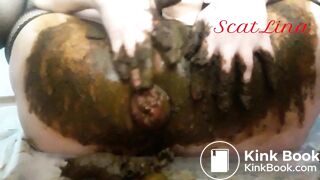 Scat anal prolapse video