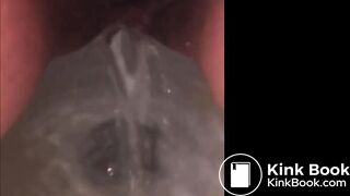 Girl shitting in public pt 2