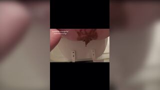 Autumn 2 day diarrhea