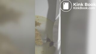 Korean girl diarrhea 2