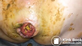 Shitty prolapse - video 4